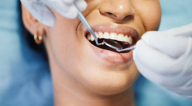 Best Dentist for Tooth Abscess  in South Barre, VT